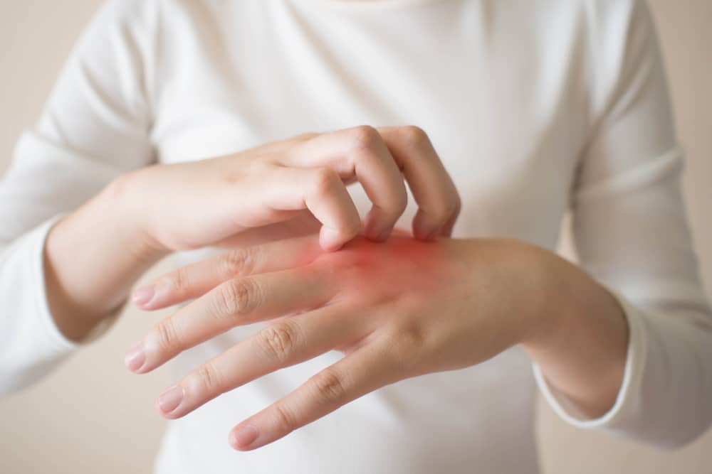 Young woman itching red skin caused by cleaning products